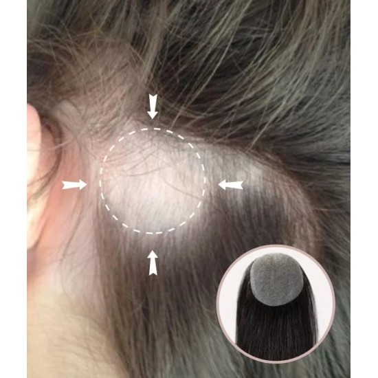 Full Skin Base Cover-Up Hair Patches Pieces Keine Chirurgische Lösung Für Alopecia Areata